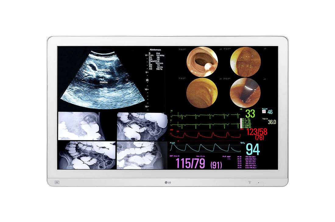 LG 31.5 (80.01cm) 4K IPS Surgical Monitor